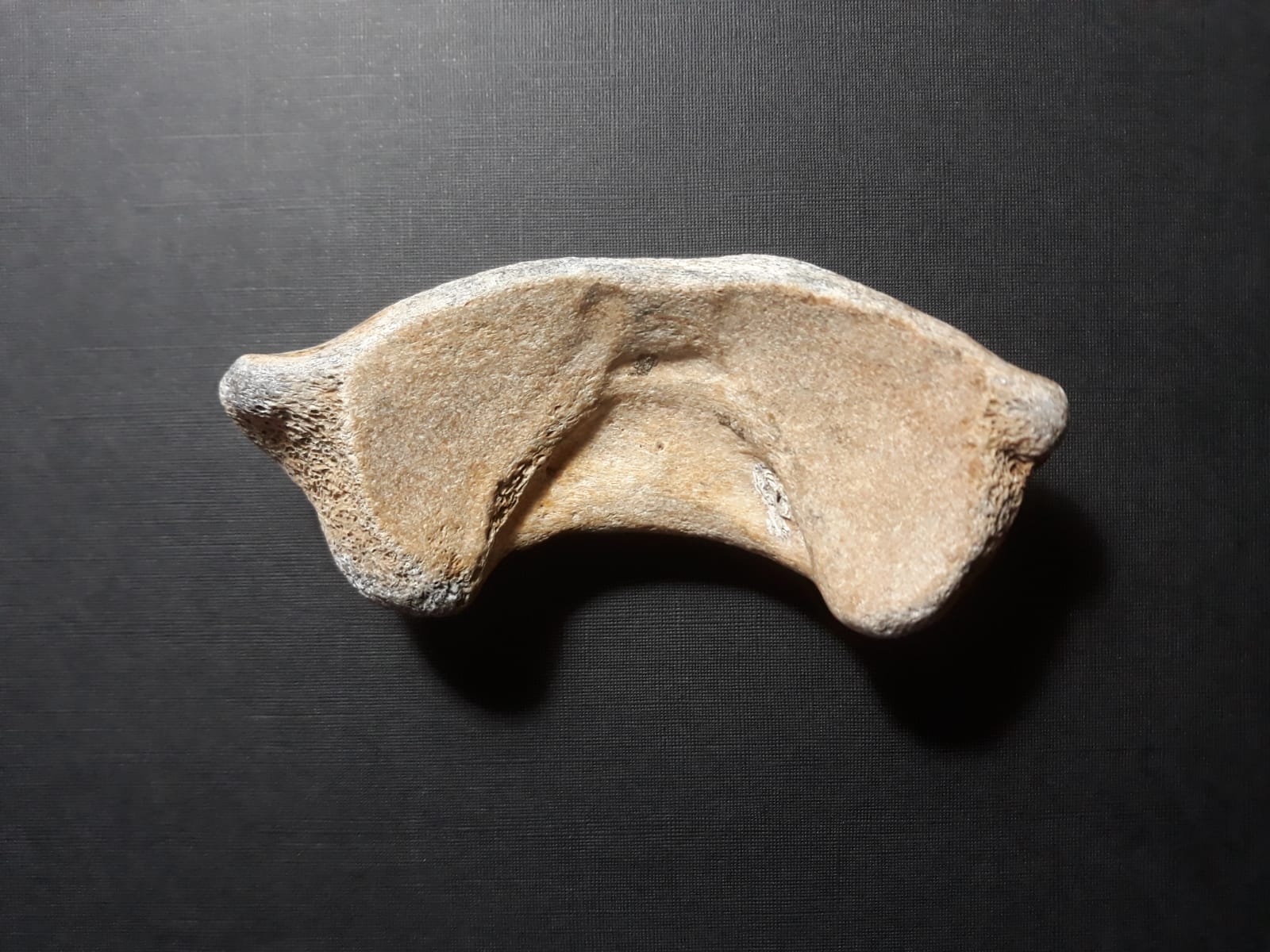 Vertebra?